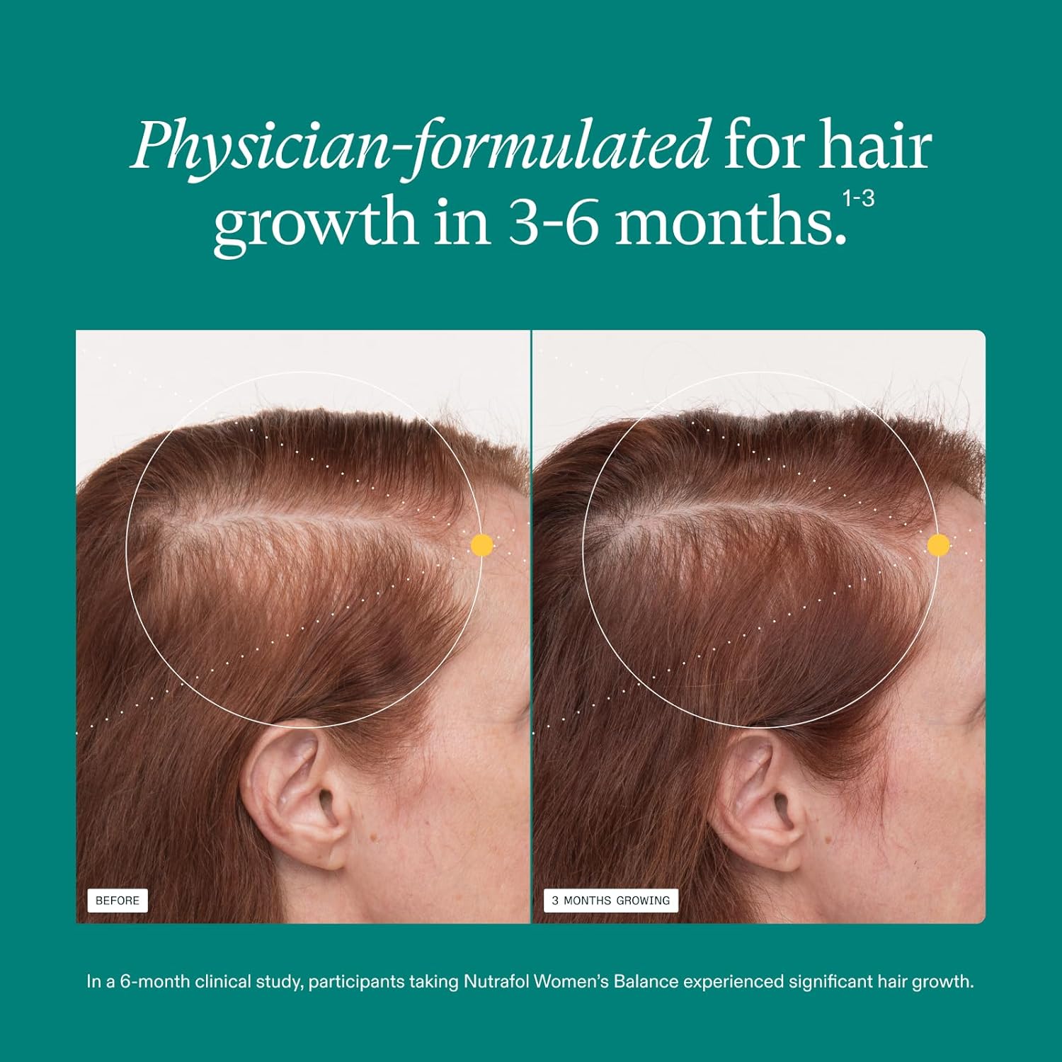 Nutrafol Women Hair Growth Supplement 120 Capsules | Women's Hair Wellness Formula