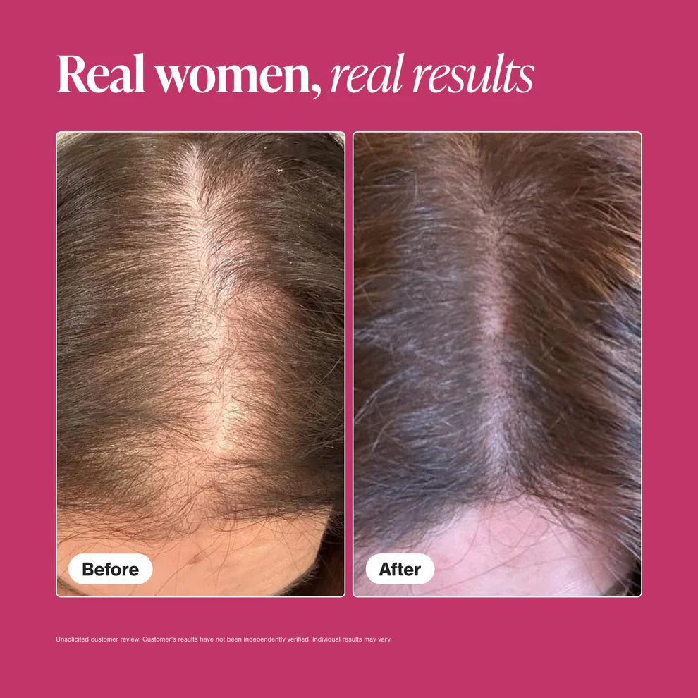 Viviscal Maximum Strength Women's Hair Growth Supplement 180 Tablets